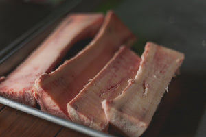 The Beauty and Wellness Elixir: The Benefits of Bone Broth for Skin and Overall Health